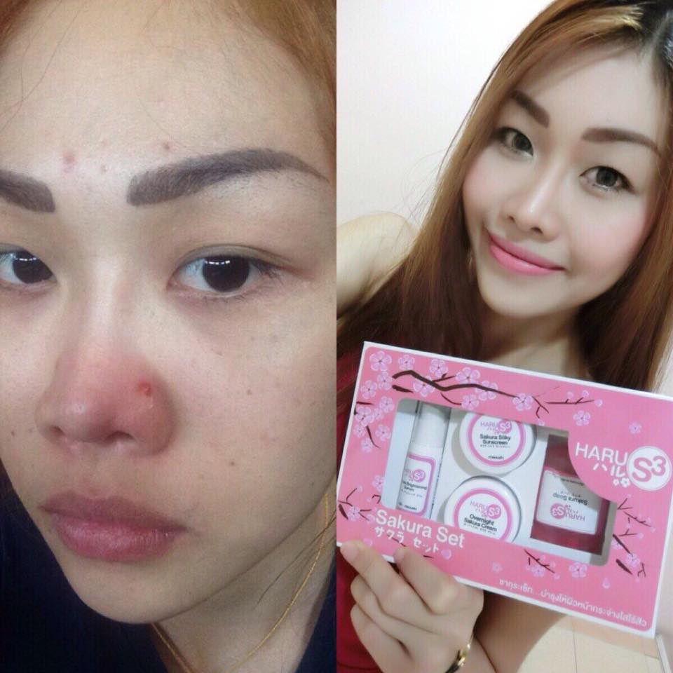 ครีมฮารุ S3 (Haru S3 Sakura Set)