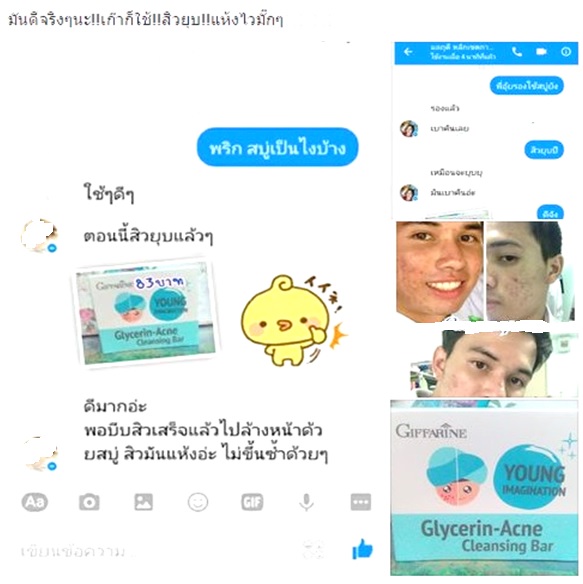 กิฟฟารีน กลีเซอรีน แอคเน่ (สบู่แก้สิว)