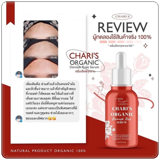เซรั่มเลือดกุหลาบ ชาริส์ Chari's Organic Damask Rose Serum (ส่งฟรี)
