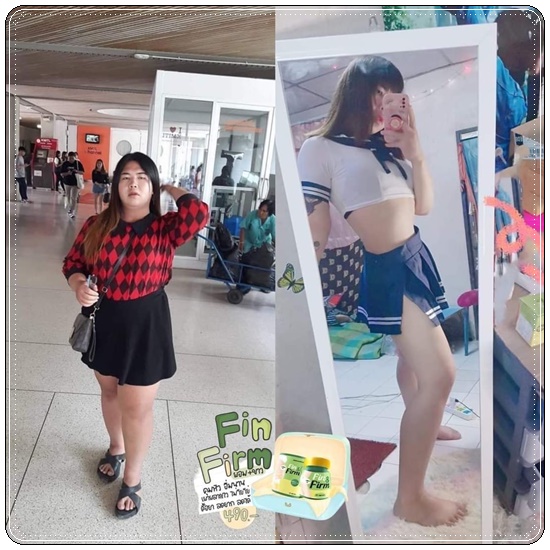 Need U ยูนีด The Richs (Finn&Fin Plus ฟินแอนด์เฟิร์ม แพ็คเกตใหม่)