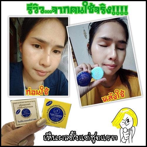 ไนท์ทีนคอสเมติก 2009 รักษาสิว ฝ้า หน้าหมองคล้ำ