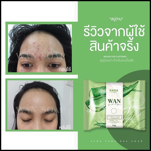 สบู่ว่าน WAN SOAP By RADA ลดสิว ผิวอักเสบ