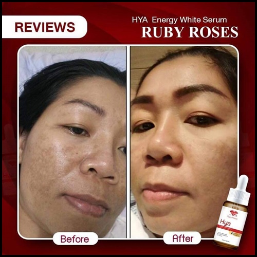 เซรั่ม Hya Energy White Serum By Ruby Roses ลดเลือนริ้วรอย
