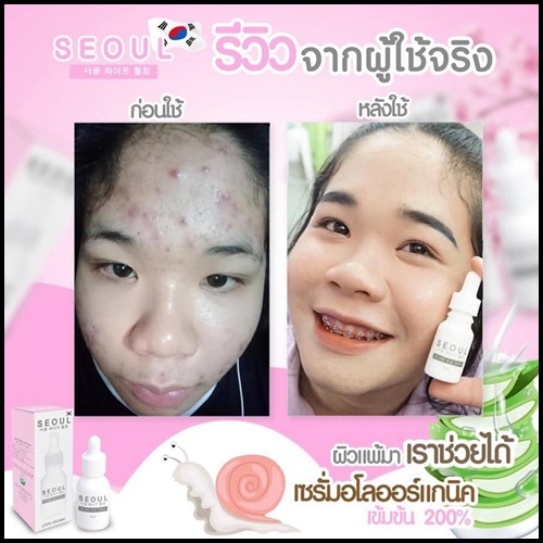 เซรั่มโซล Seoul Organic Aloe Serum เซรั่มอโลออร์แกนิค เข้มข้น
