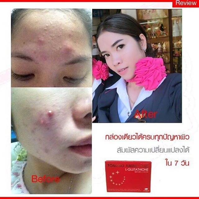 TOMATO Amino Plus L-glutathione สูตรใหม่ (โทเมโท อะมิโน พลัส แอลกลูต้าไธโอน)