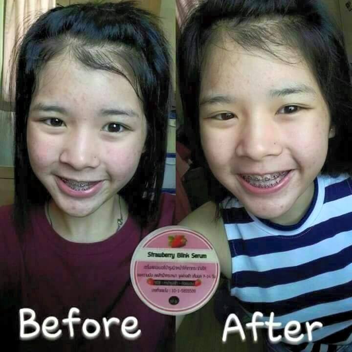 สตรอเบอรี่ บริ้ง เซรั่ม (Strawberry Blink Serum)