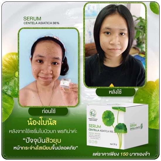 เซรั่มใบบัวบก ผสมว่านหางจระเข้ Serum Centella Asiatica Pontina