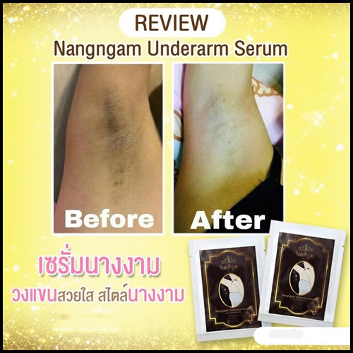 เซรั่มรักแร้นางงาม NangNgam (ยกกล่อง 10 ซอง)