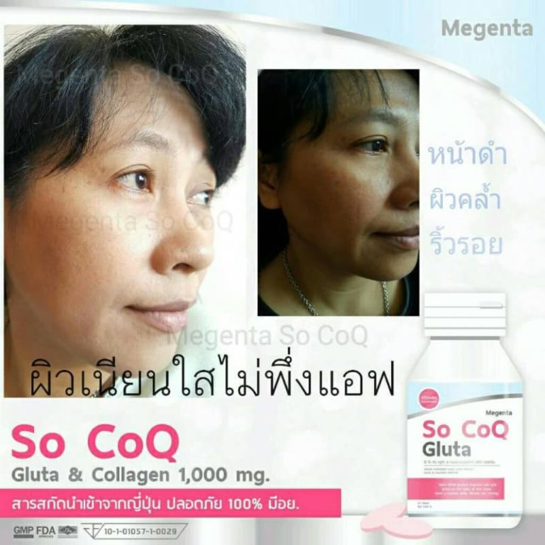 โซโคคิว กลูต้า (กลูต้าหิมะ So CoQ Gluta) โปรส่งฟรี EMS