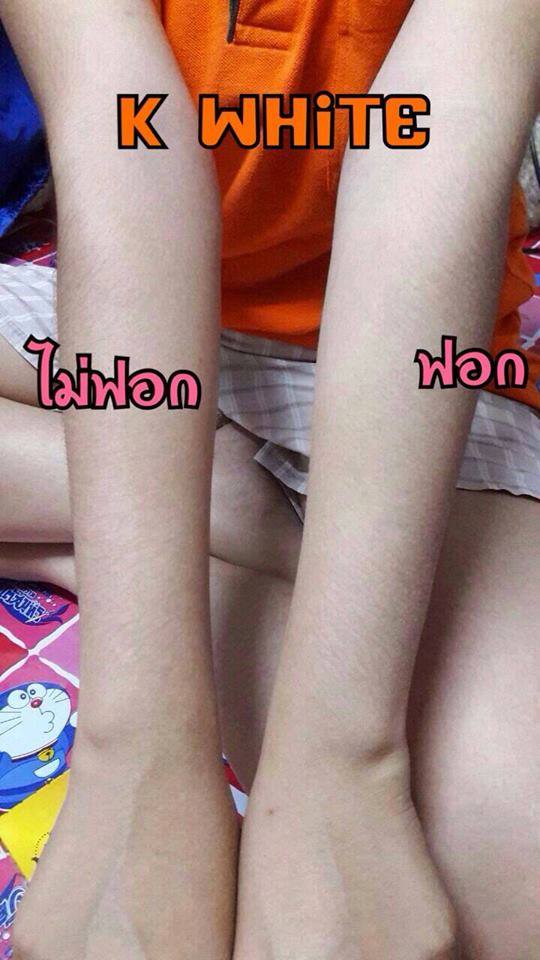 สบู่สครับผิวชาโคล K WHITE