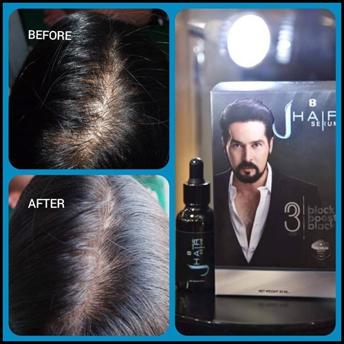 เจแฮร์ เซรั่ม J-Hair Serum เซรั่ม ปลูกผม ปลูกหนวด by จอนนี่ แอนโฟเน