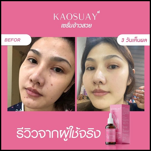 เซรั่มข้าวสวย Kaosuay ลดฝ้า กระ