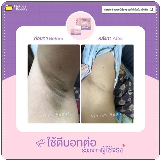 ออนนี่ ครีมรักแร้ขาว Onny White Cream VictoryBeauty