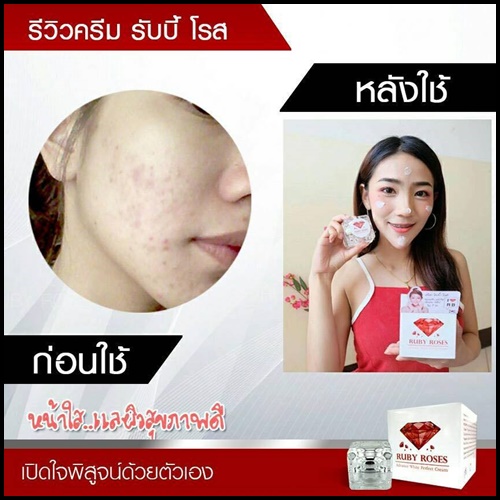 รับบี้ โรส ครีม Ruby Roses Cream ครีมรากหญ้า