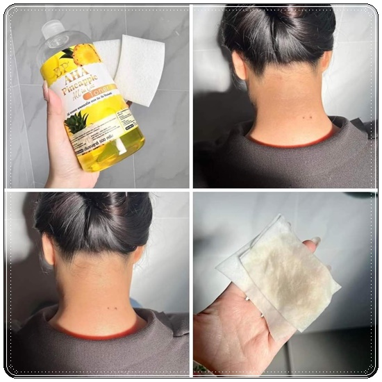 โทนเนอร์สับปะรด BP AHA Pineapple All in One Toner โทนเนอร์เช็ดขาว (1แถม1)