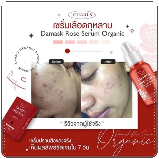 เซรั่มเลือดกุหลาบ ชาริส์ Chari's Organic Damask Rose Serum (ส่งฟรี)