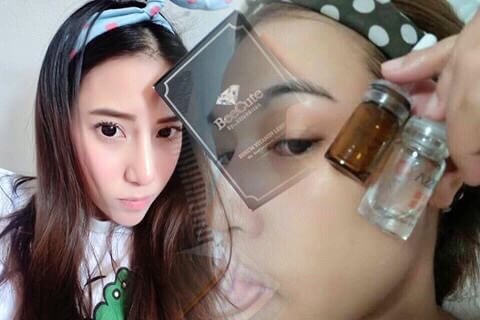 วิตามินเลเซอร์หน้าใส (Serum Vitamin Leser Beecute By BllnkBllnk)
