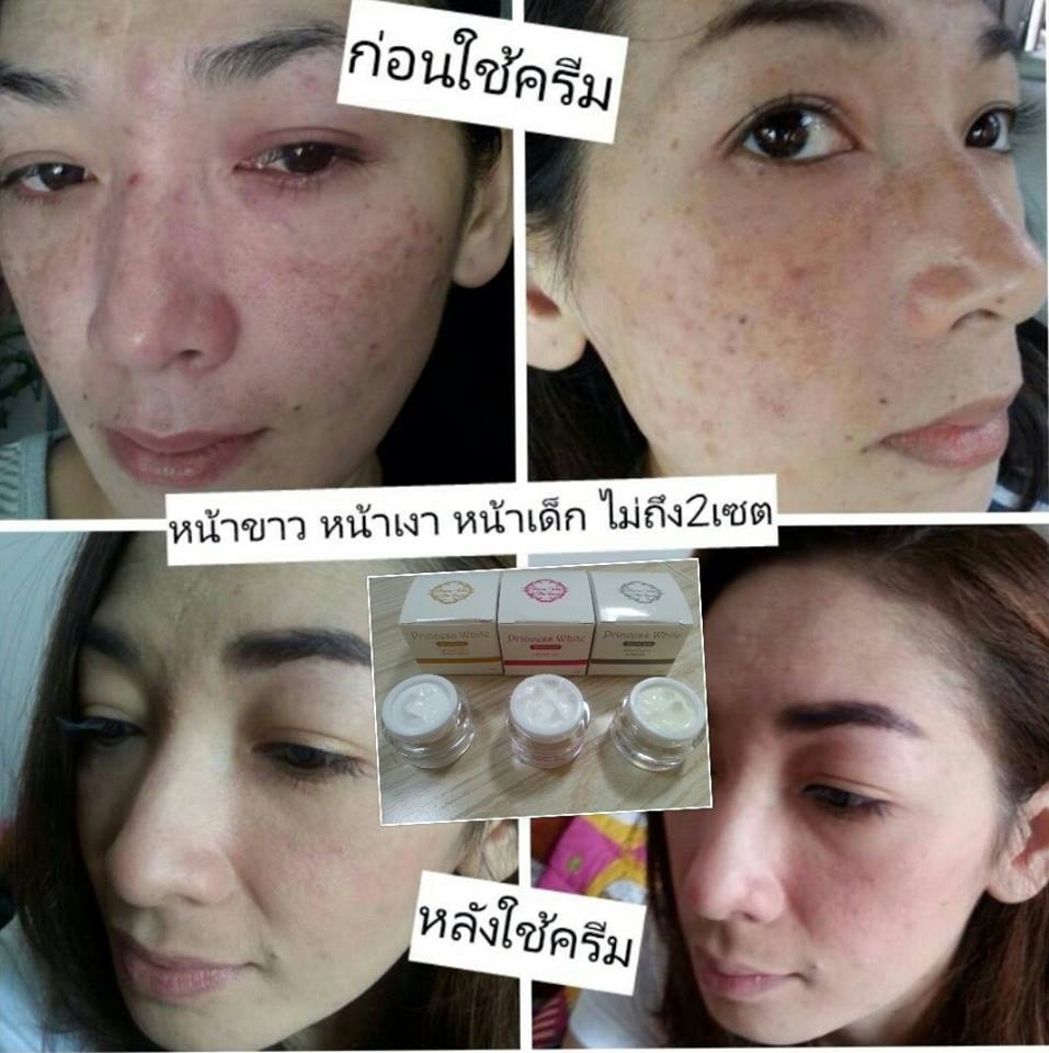 ครีมหน้าขาว (Princess White)