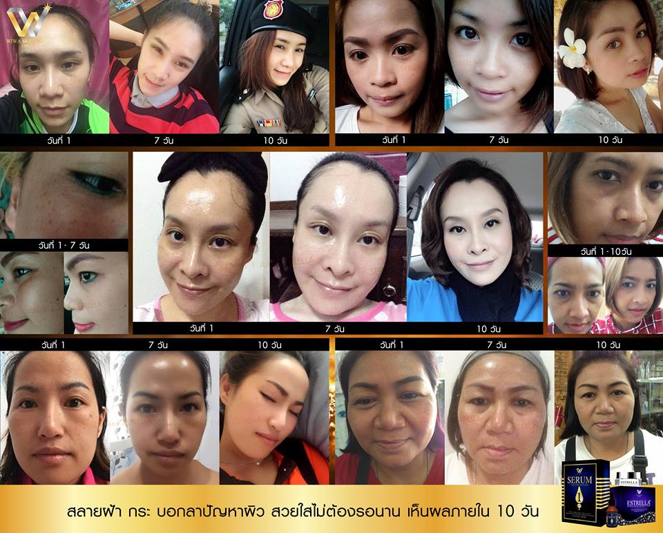 เอสเทรลล่า หน้าสวย กระจ่างใส ไร้จุดด่างดำ (Estrella Whitening and Anti-aging Moisturizer by Wiwa Skincare Expert)