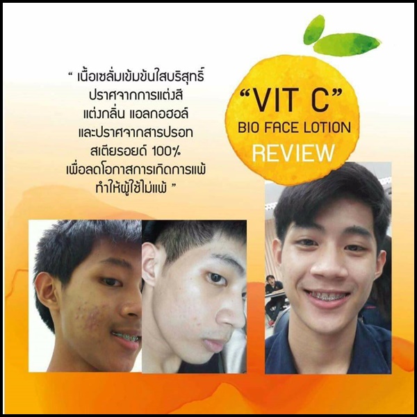 เซรั่ม VitC bio face lotion