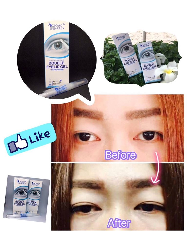 ปากกาทำตาสองชั้น Double Eyelid Gel