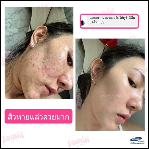 Somin Vita โซมิน ไวต้า (โปรส่งฟรี)