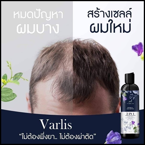 แชมพูสมุนไพร วาริส SHAMPOO VARLIS (โปรส่งฟรี)