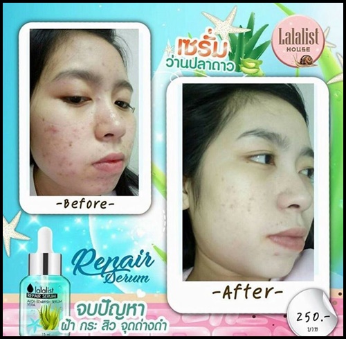 เซรั่มว่านปลาดาว Lalalist Repair Serum