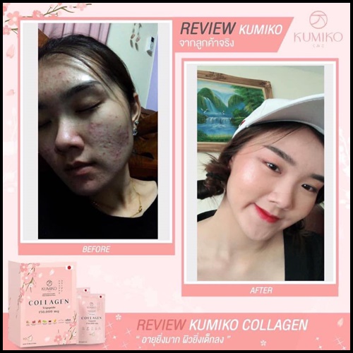 คูมิโกะ คอลลาเจน KUMIKO Collagen Premium
