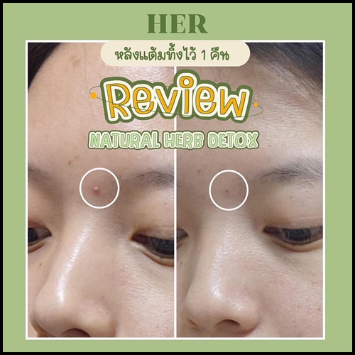 มาส์กสมุนไพรสกัดเย็น คั้นสด HER Natural Herbs Detox Plus