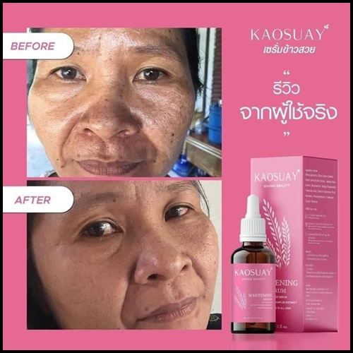 เซรั่มข้าวสวย Kaosuay ลดฝ้า กระ