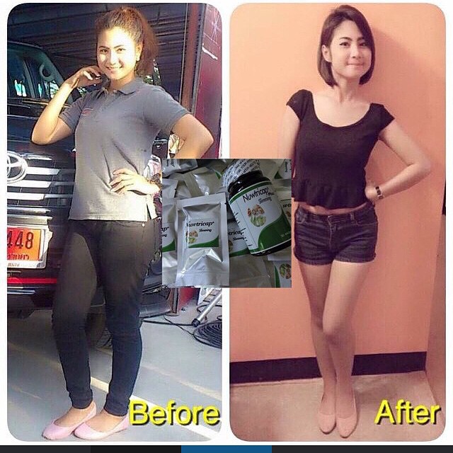 นรูติแคป ผอมเพรียว หุ่นเป๊ะ (Nuwtricap slimming plus)