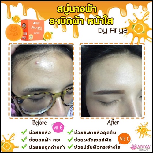 สบู่นางฟ้า ระเบิดฝ้า หน้าใส Nangfa Soap By Ariya