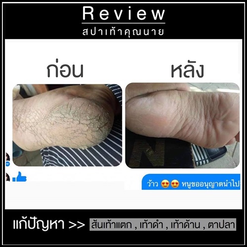 สปาเท้าคุณนาย สูตรใหม่