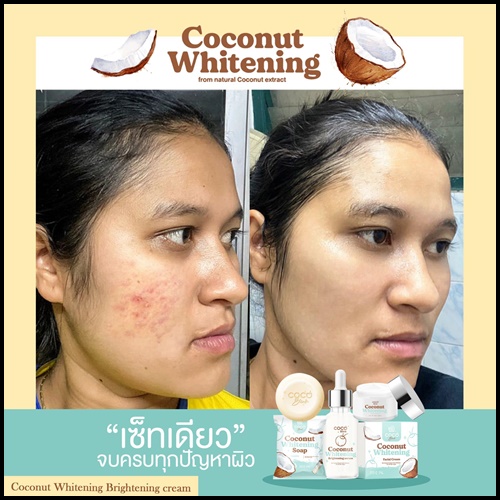 Coconut Blink Whitening โคโค่บลิ้ง ไวท์เทนนิ่ง เซ็ตบำรุงผิวหน้า