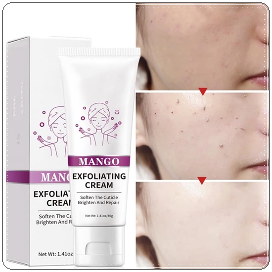 เจลมะม่วงสครับผิว RtopR mango Exfoliating Cream เจลขัดสิวเสี้ยน