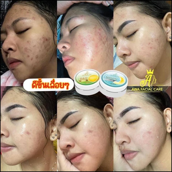 ครีมเอวา AWA Facial Care (ส่งฟรี)