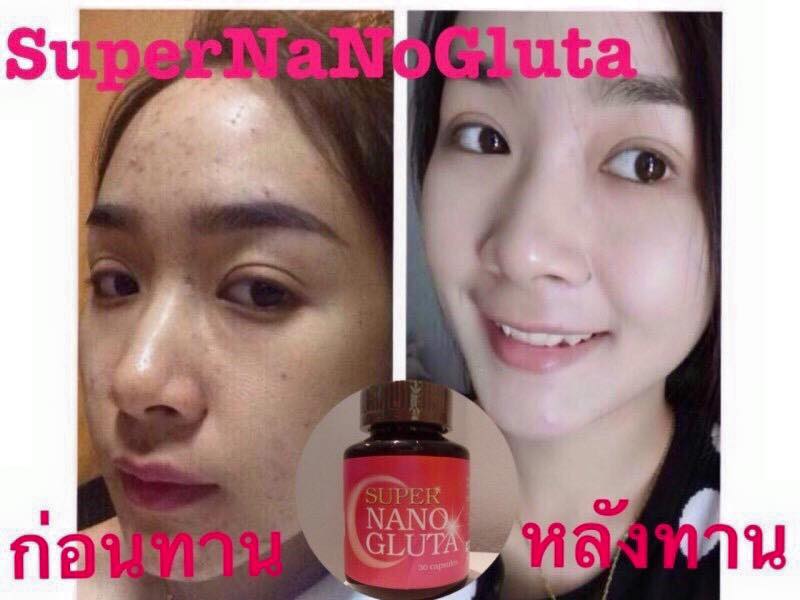 ซุปเปอร์นาโนกลูต้า (Super Nano Gluta)