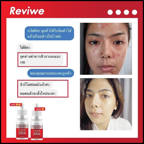 เซรั่มไฮยาดา Hyada Go-VC Vitamin Hyaluronic Acid Serum (1 แถม 1)
