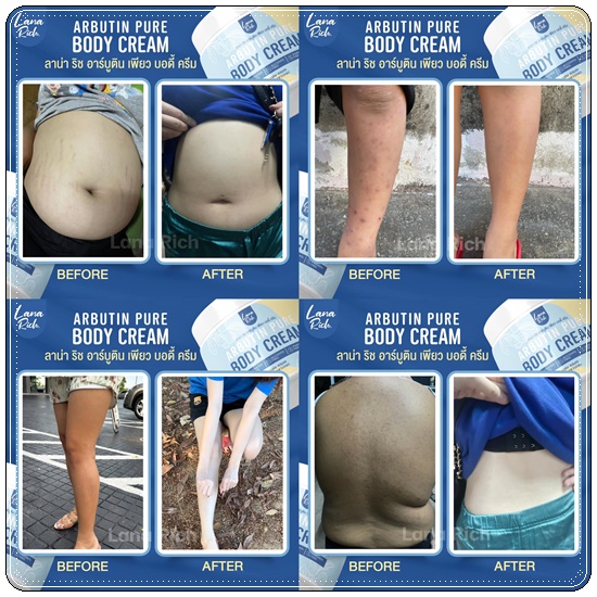 อาร์บูตินเพียว Lana Rich Arbutin Pure Body Cream