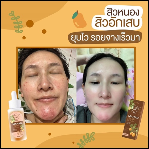 เซรั่มมะหาดธิดา Mahad Facial Serum BY Thida