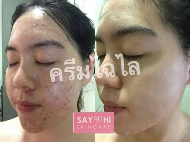 ไฉไลครีม By Say Hi Skincare