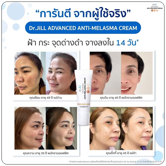 ครีมทาฝ้า Dr.Jill Advanced Anti-Melasma Cream (ส่งฟรี)