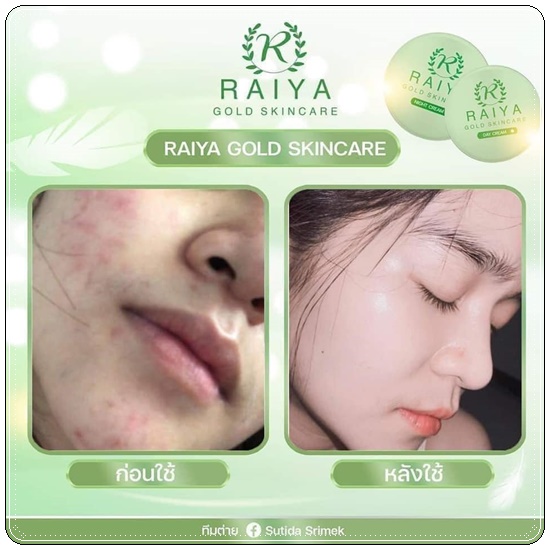 ครีมไรยา Raiya Gold Skincare