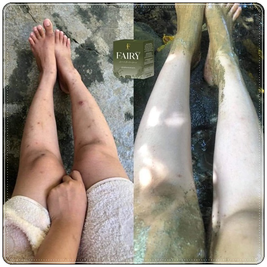 สบู่สครับแฟรรี่ Fairy Scrub Gluta Soap สครับกลูต้าแฟรี่