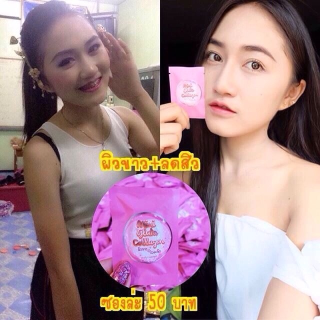 มินิกลูต้าคอลลาเจน Mini Gluta Collagen โปรสุดคุ้ม