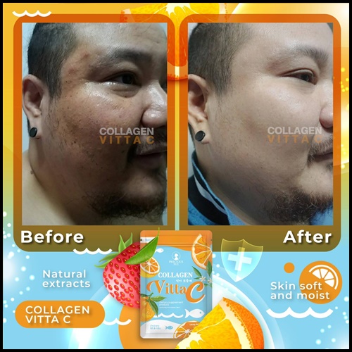 Collagen VittaC BY Precious Skin