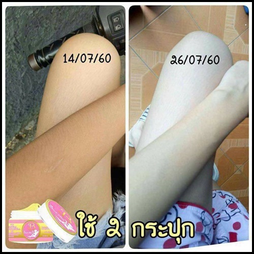 โสมโบเต้บลิ้งค์ Beaute Blink