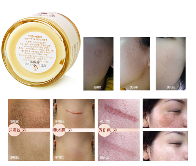 ครีมน้ำมันม้า Guerisson 9 Complex Cream