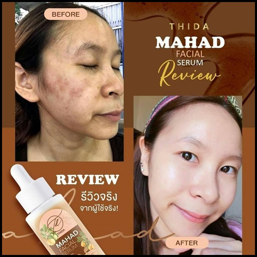 เซรั่มมะหาดธิดา Mahad Facial Serum BY Thida
